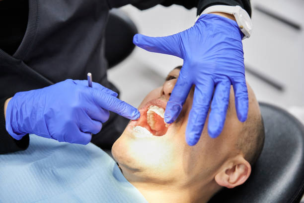 Best Emergency Dental Care for Broken or Chipped Teeth in Bunker Hl, IL