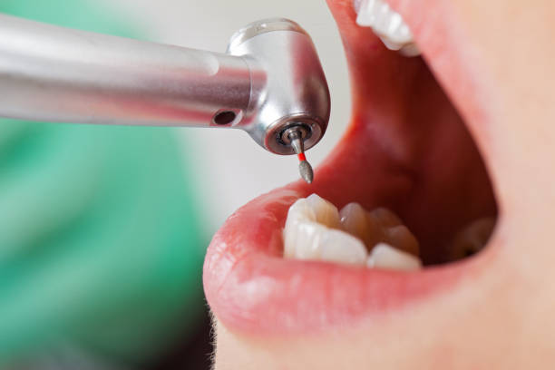 Best Emergency Orthodontic Services in Bunker Hl, IL